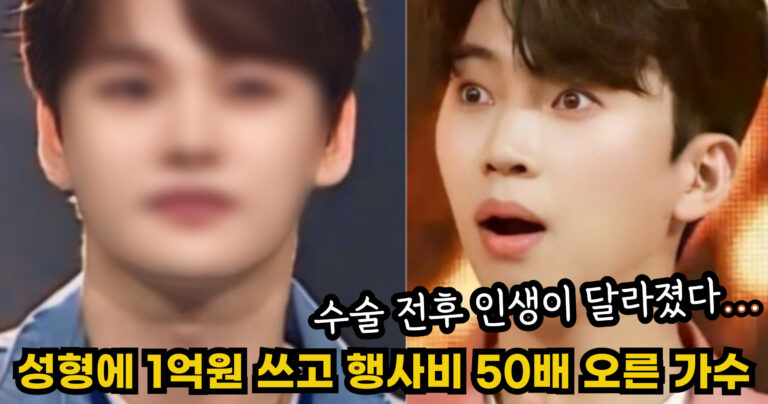 “수술 전후 인생이 달라졌다…” 얼굴 성형에 1억원 쓰고 행사비 50배 오른 가수의 정체