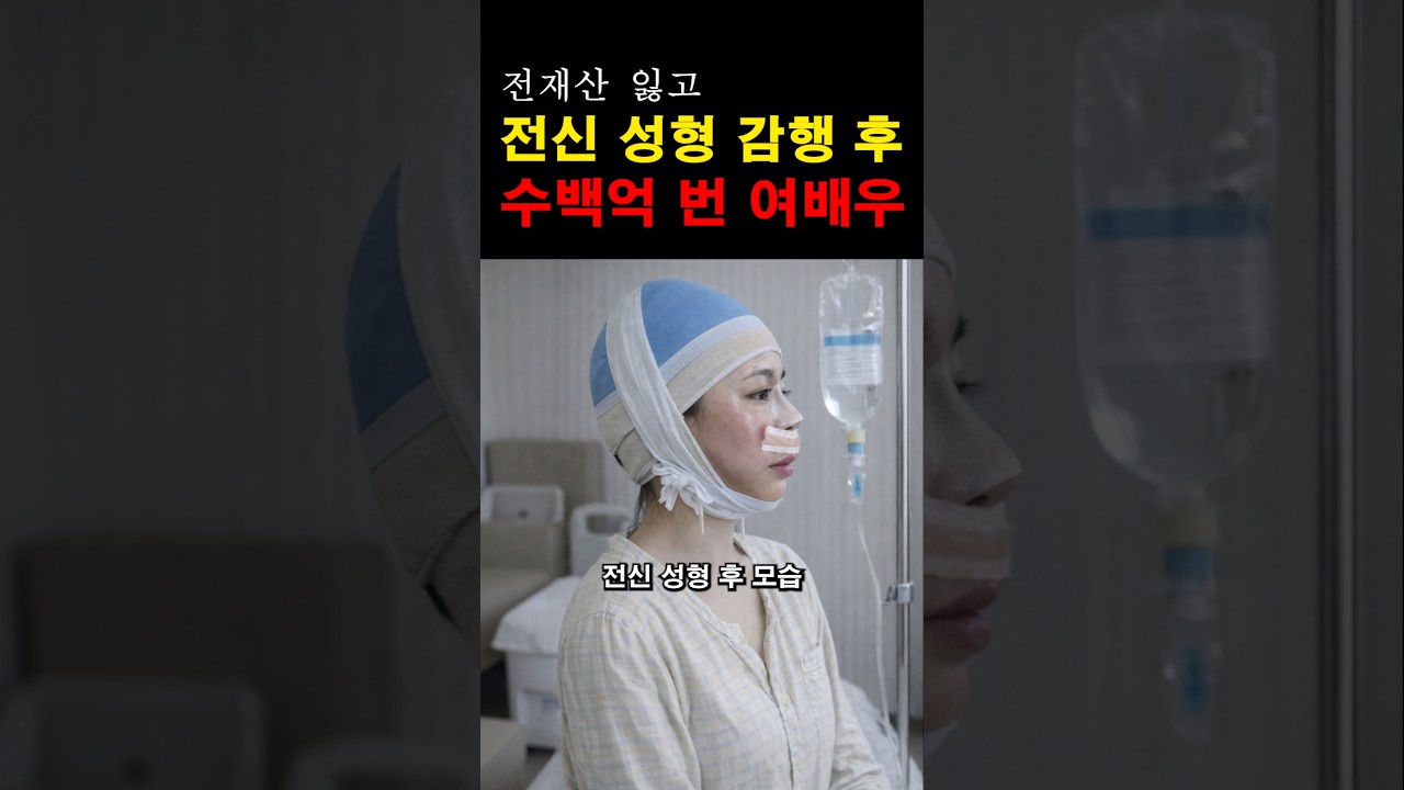 “이렇게 변할 수 있다니…” 전신 성형 후 톱스타 반열에 오른 여배우의 숨겨진 진실
